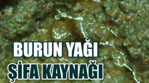 Çiğ Burun Yağı Şifa Kaynağı
