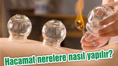 Hacamat nerelere nasıl yapılır?